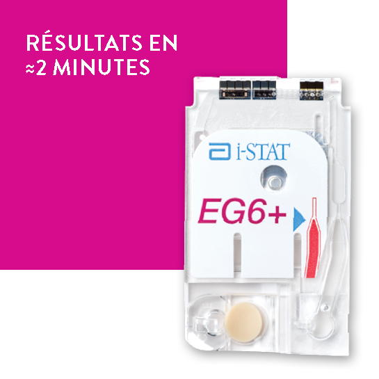 Abbots Rals Poc i-STAT EG6+ Cartridge | Diagnostic rapide en POC – Abbott