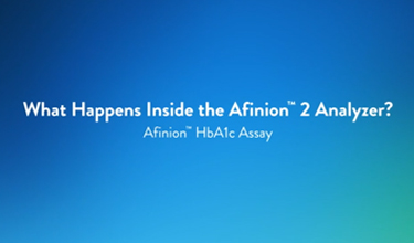 Im Inneren des Afinion