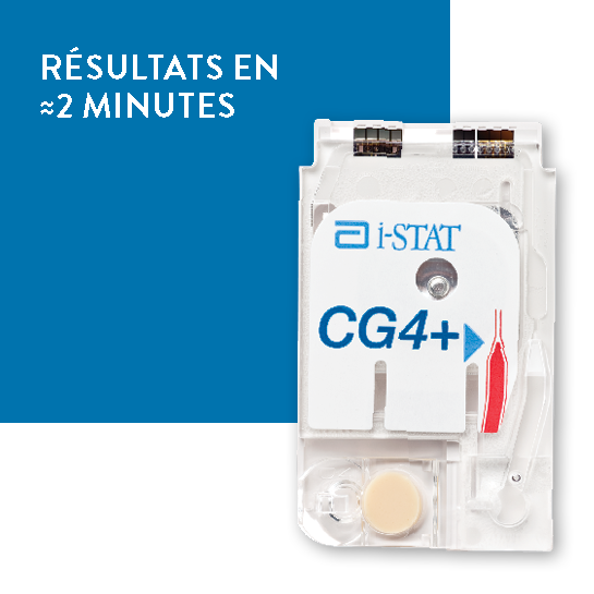 i-STAT CG4+ Cartridge (white)  Diagnostic rapide en POC – Abbott