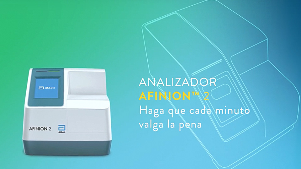 Vea el tutorial en vídeo sobre la descarga de la actualización del software Afinion