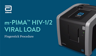 FINGERBEERENPUNKTION FÜR DEN M-PIMA™ HIV-1/2 VIRAL LOAD TEST