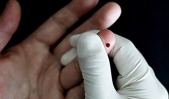 SD BIOLINE HIV/Syphilis Duo Vídeo de treinamento (sangue)