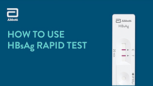 Bioline HBsAg Rapid Test Procedure Demo Video