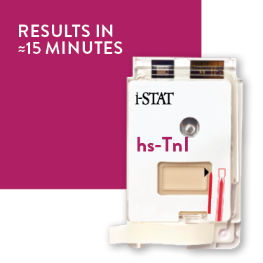 i-STAT hs-TnI