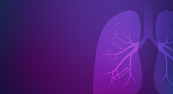 Health Impact of tuberculosis 