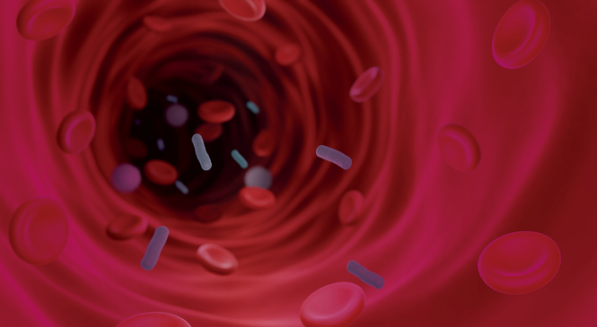 sepsis outcomes